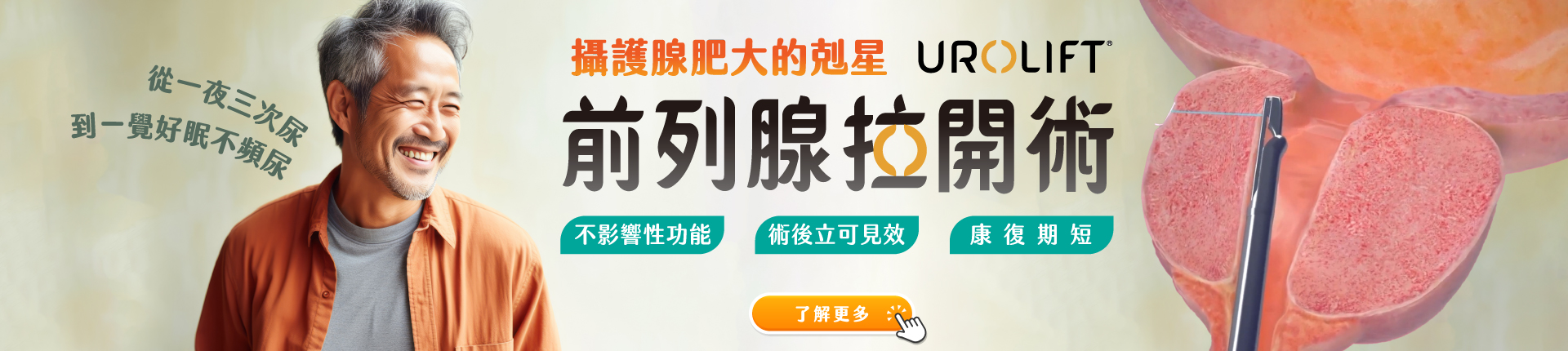 UroLift前列腺拉開術-攝護腺肥大的剋星 UroLift前列腺拉開術-攝護腺肥大的剋星