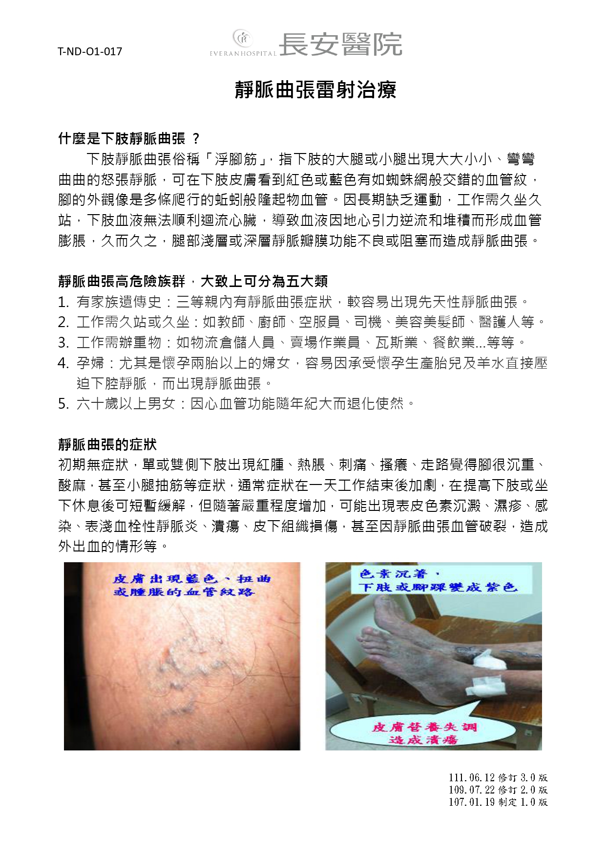 台中長安醫院心臟血管內科衛教 - 靜脈曲張雷射治療 (第 1 頁)