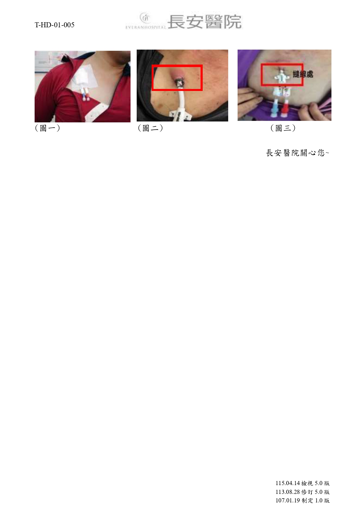 台中長安醫院腎臟內科衛教 - 血液透析病患雙腔導管留置須知 (第 2 頁)