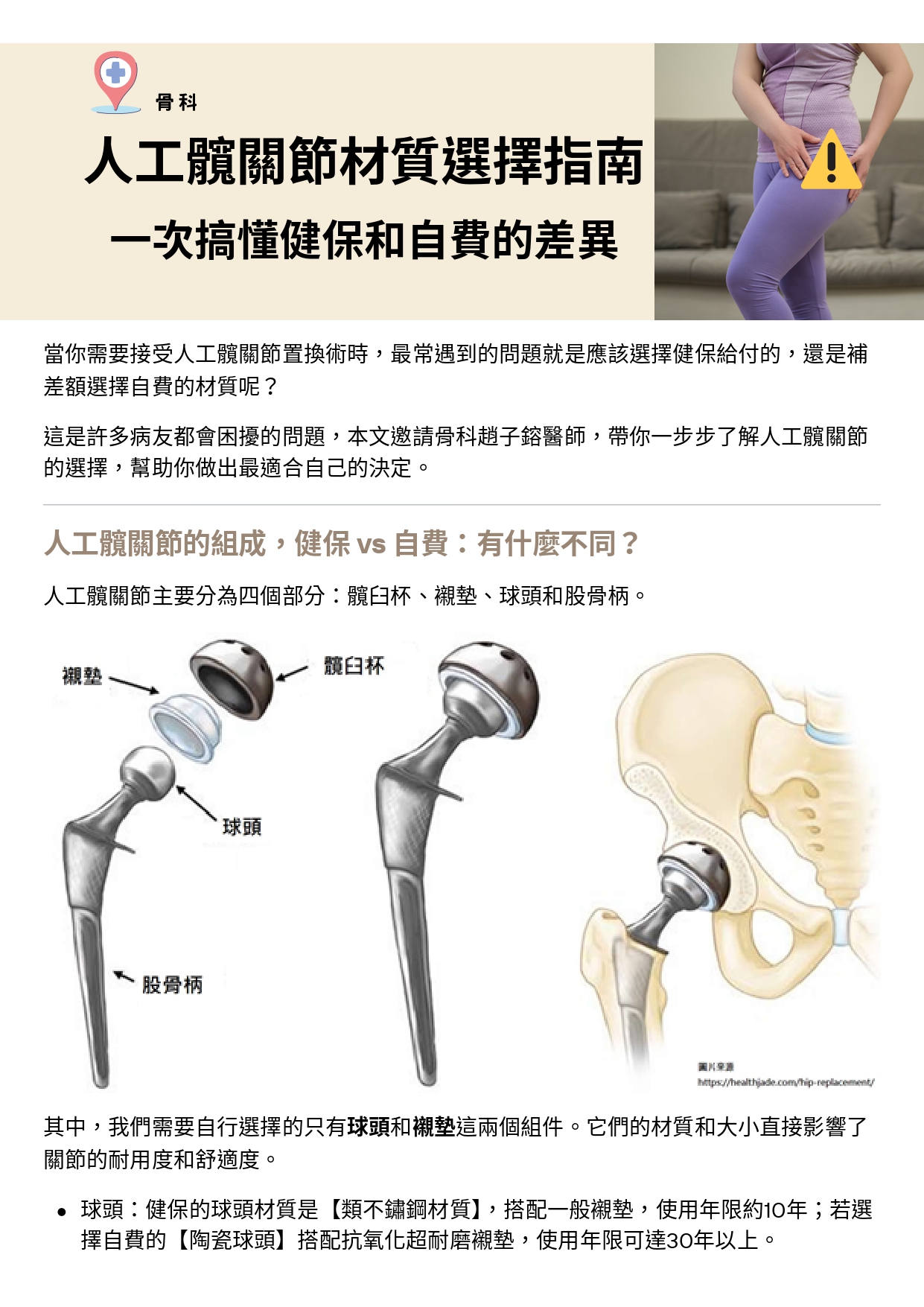 台中長安醫院骨科衛教 - 人工髖關節材質選擇指南 (第 1 頁)