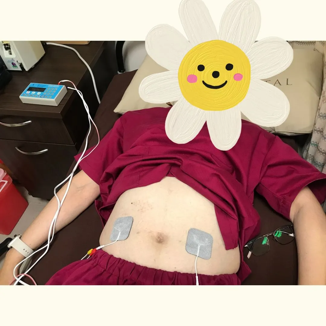 FSM 頻率共振微電流治療