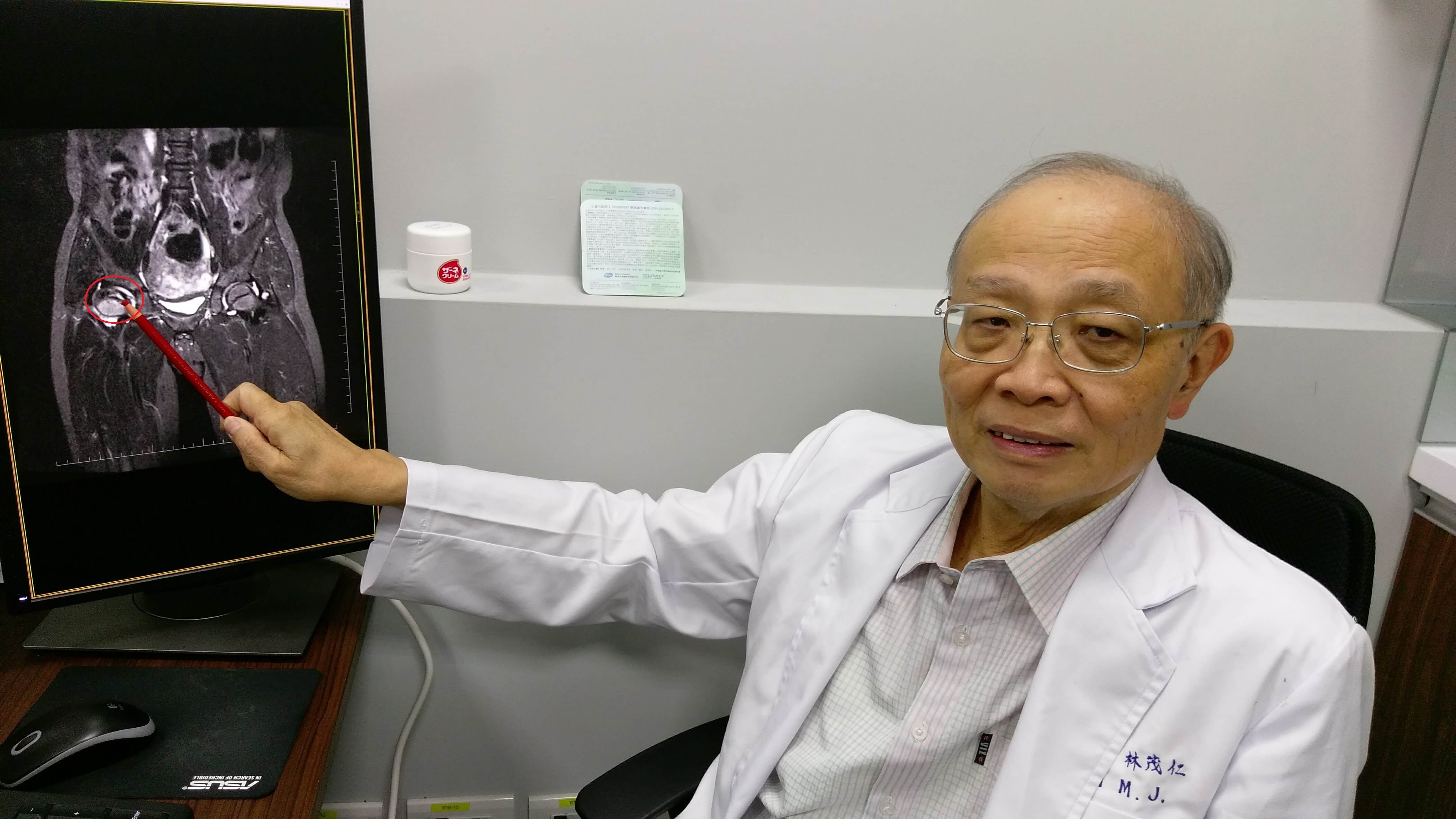 6歲小弟弟股骨頭缺血性壞死幸早發現免惡化