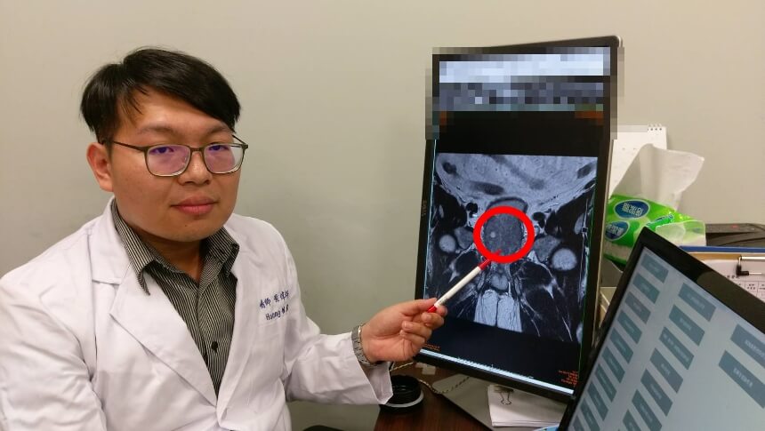 攝護腺肥大如蘋果 尿不出急送醫雷射治療