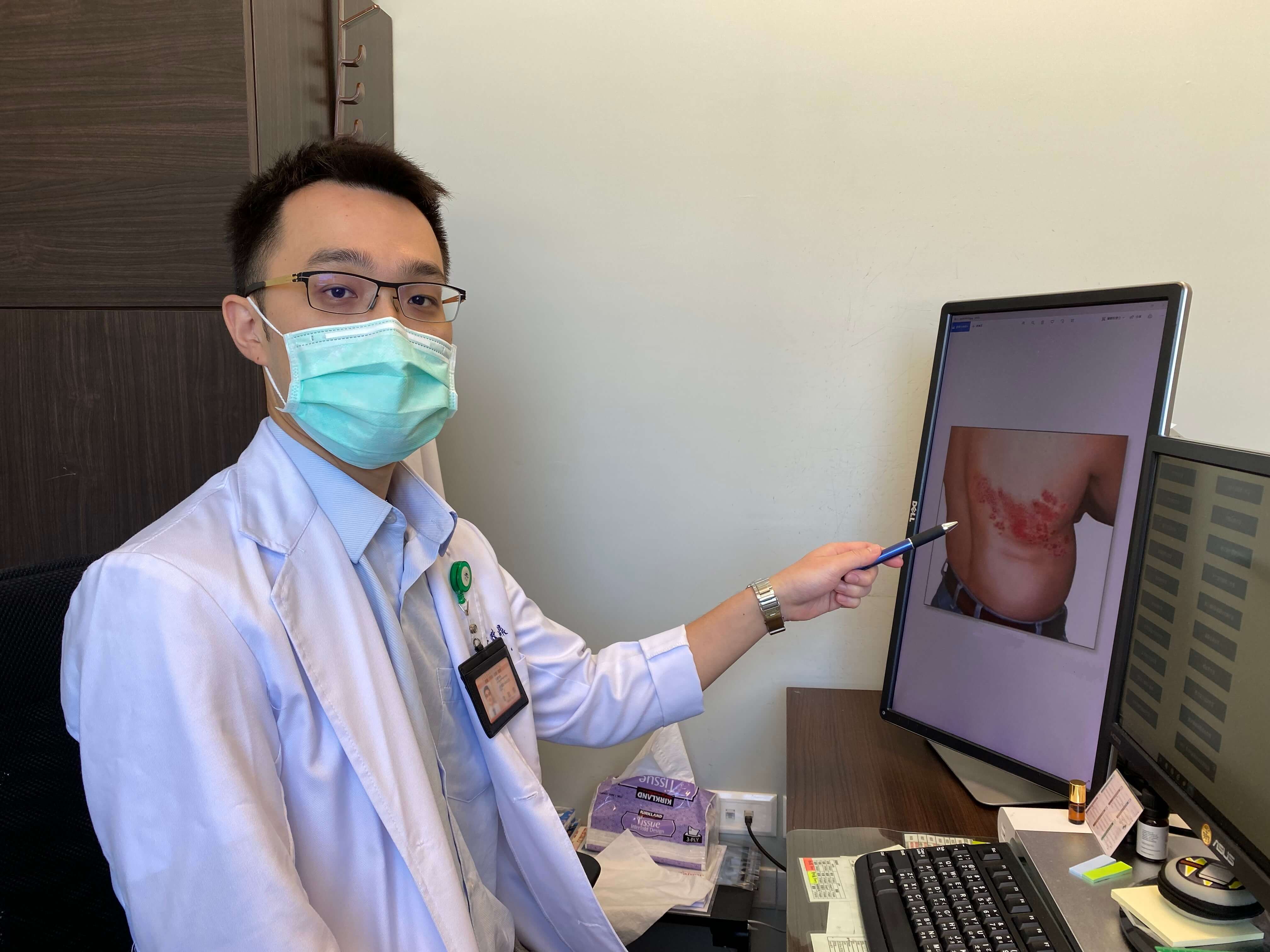腎友藥注意! 帶狀疱疹藥致昏迷