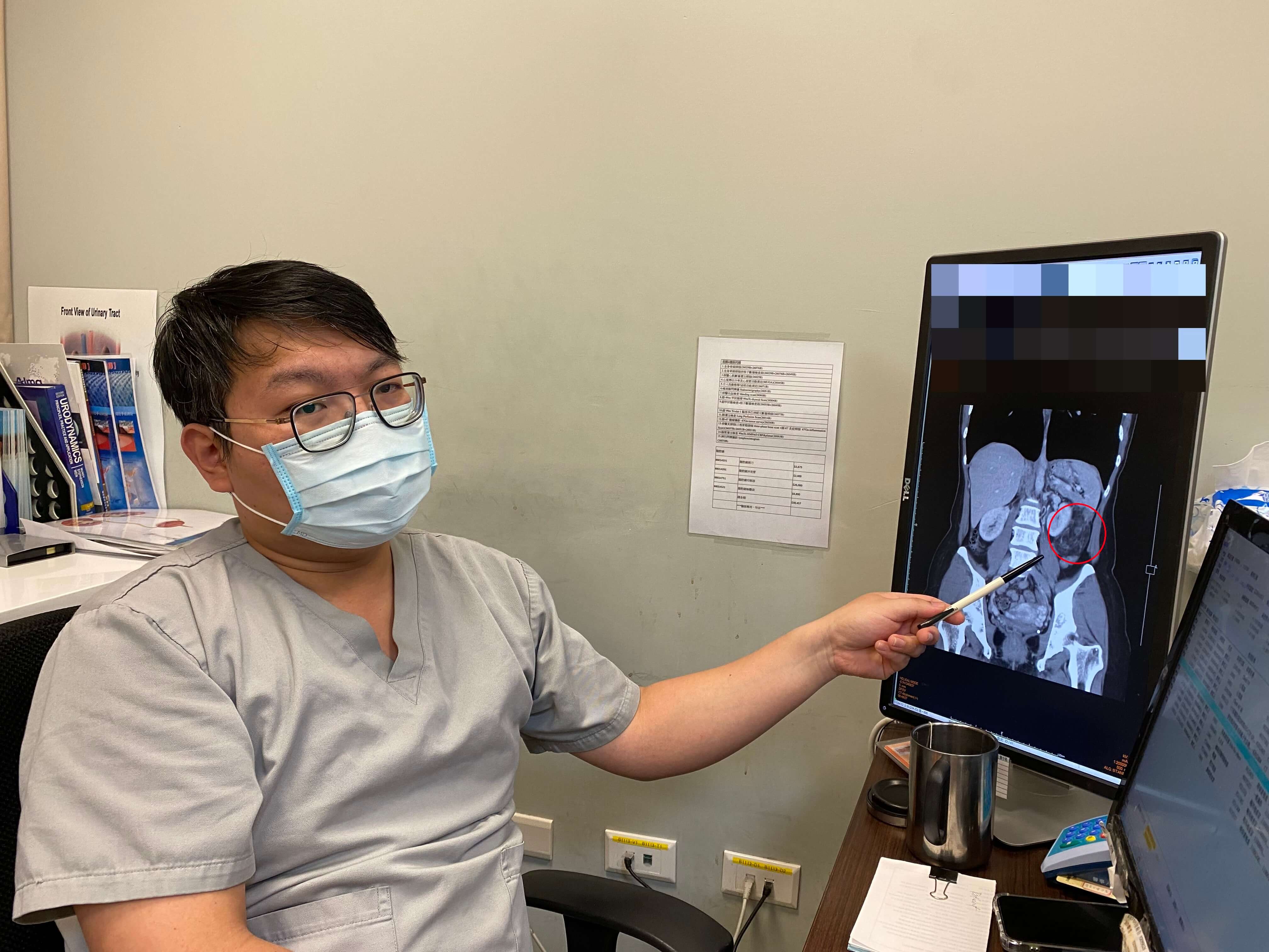 腰痛不適發現8公分腫瘤 腹腔鏡手術保腎、降洗腎機率