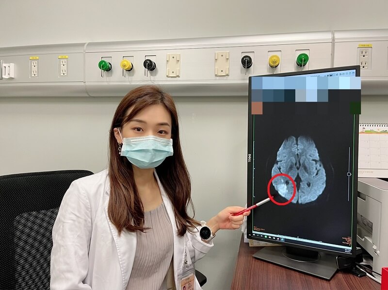 改善急性腦中風失用症 靜脈雷射幫大忙
