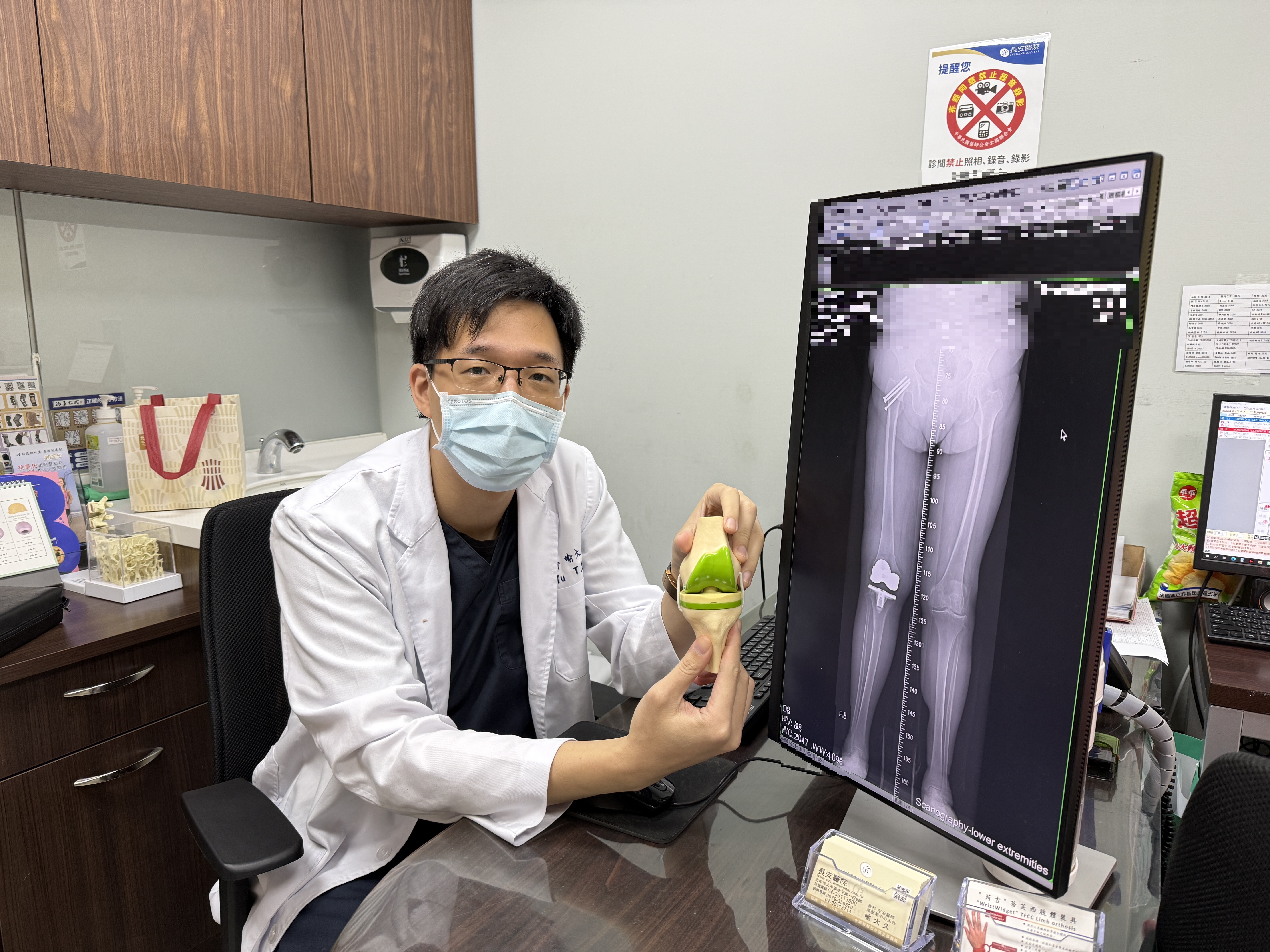 8旬嬤X型腿走路互撞慘跌骨折　人工膝關節置換改善行走
