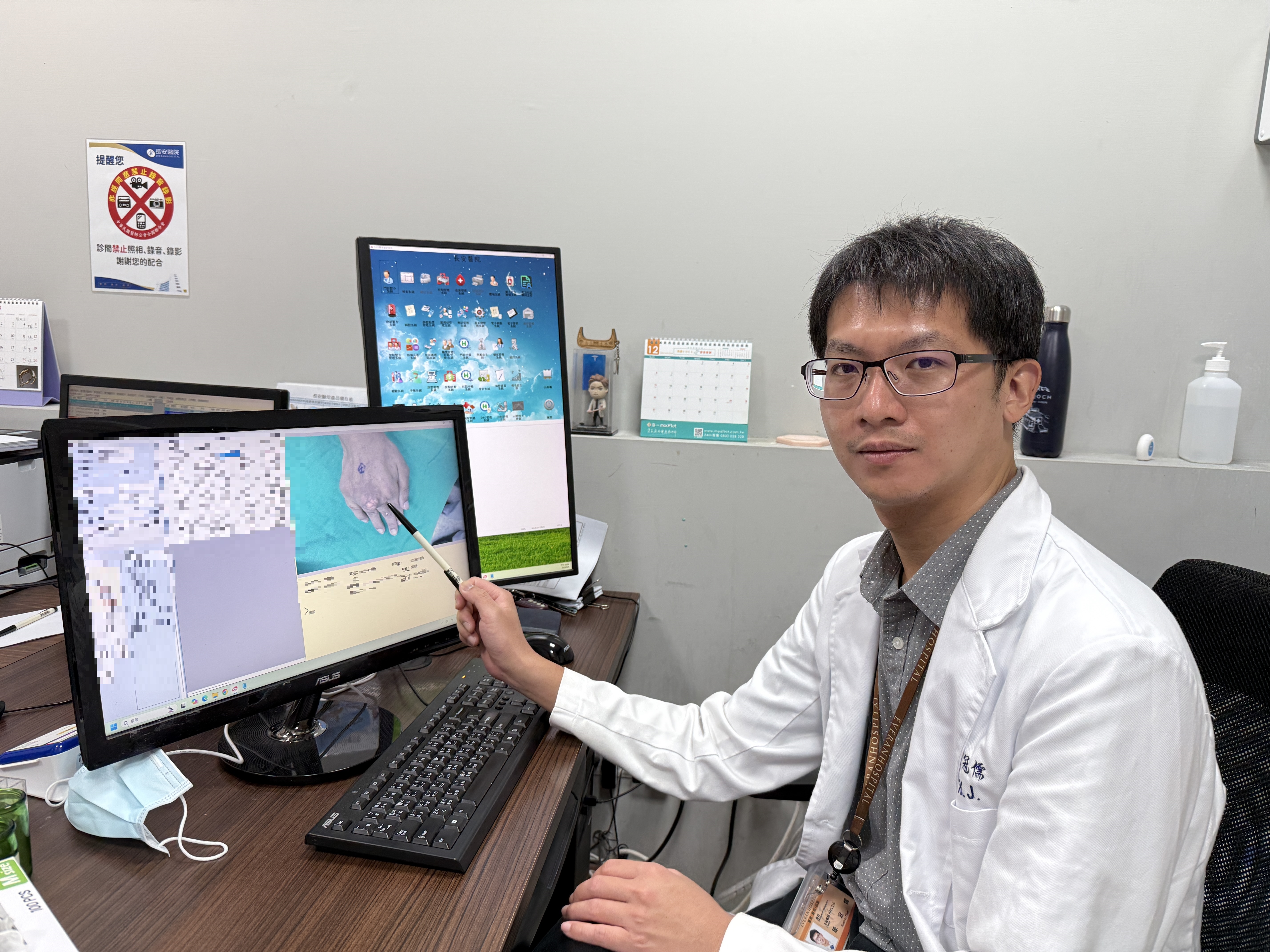 痛風石纏手10年險潰破 「微創痛風石切除手術」護關節 痛風石纏手10年險潰破 「微創痛風石切除手術」護關節