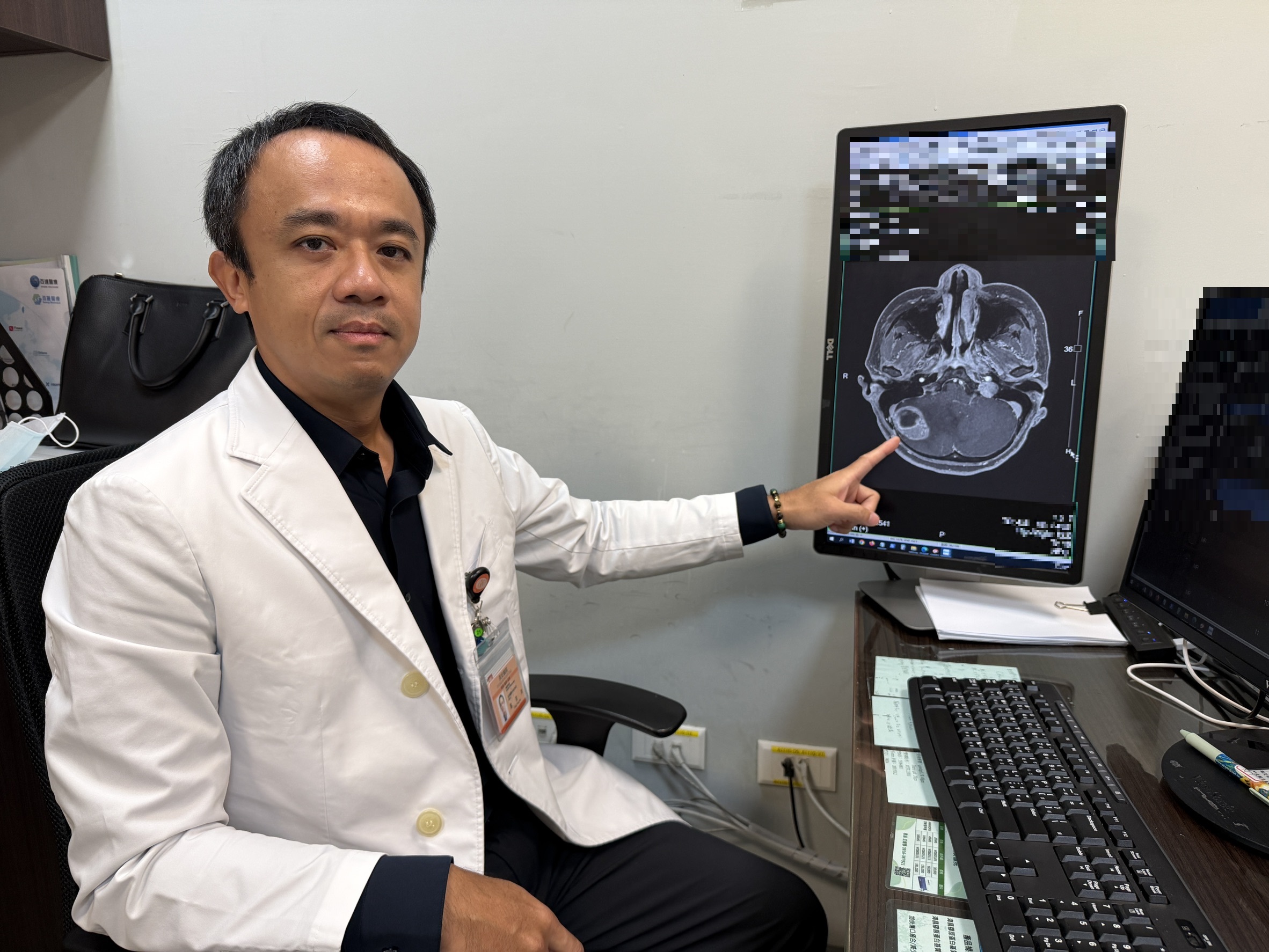 頭暈嘔吐以為只是化療副作用? 乳癌婦驚查小腦長3.7cm腫瘤!「3D導航+超音波腫瘤吸引器」精準拆彈 頭暈嘔吐以為只是化療副作用? 乳癌婦驚查小腦長3.7cm腫瘤!「3D導航+超音波腫瘤吸引器」精準拆彈