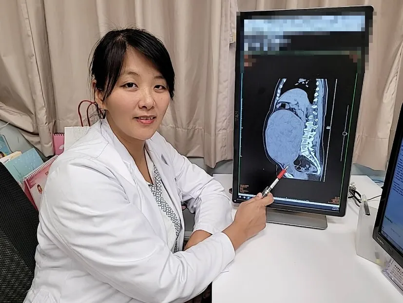 五旬婦人懷胎十月?子宮肌瘤比雙胞胎還大