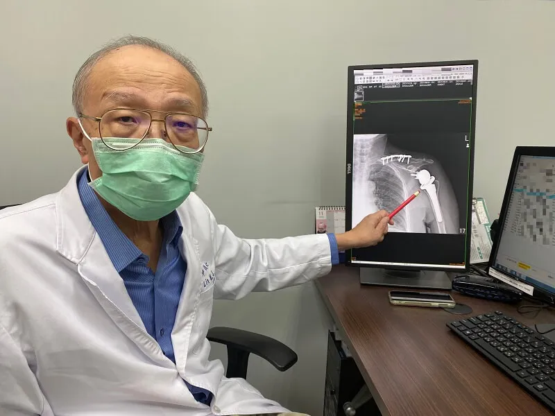 反式人工肩關節 手高舉不再是問題!