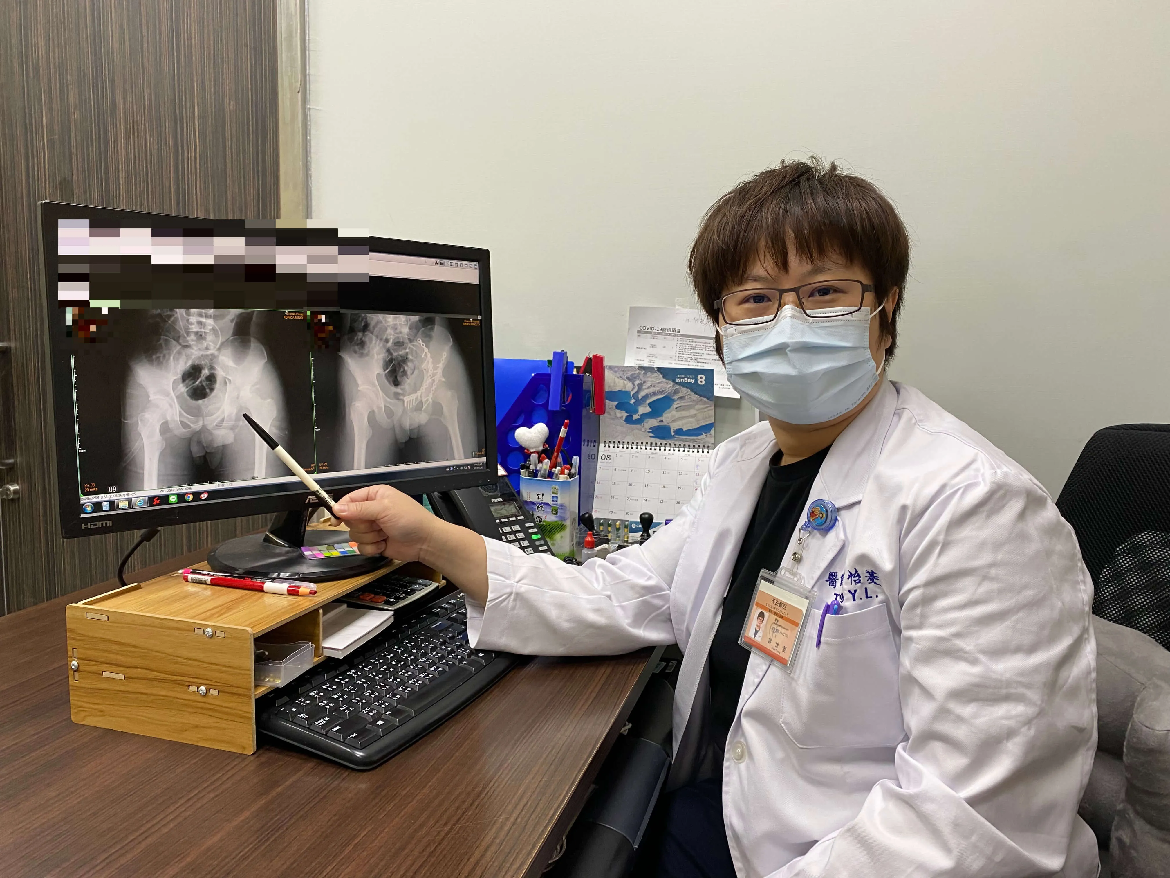 車禍髖臼骨折 微創骨折復位固定術助恢復行走