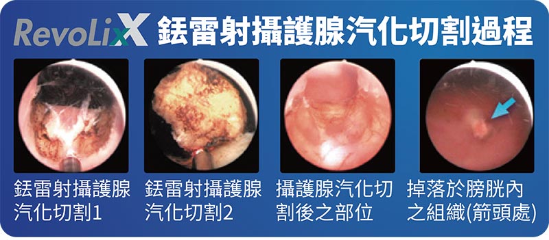 泌尿專科治療中心｜長安醫院