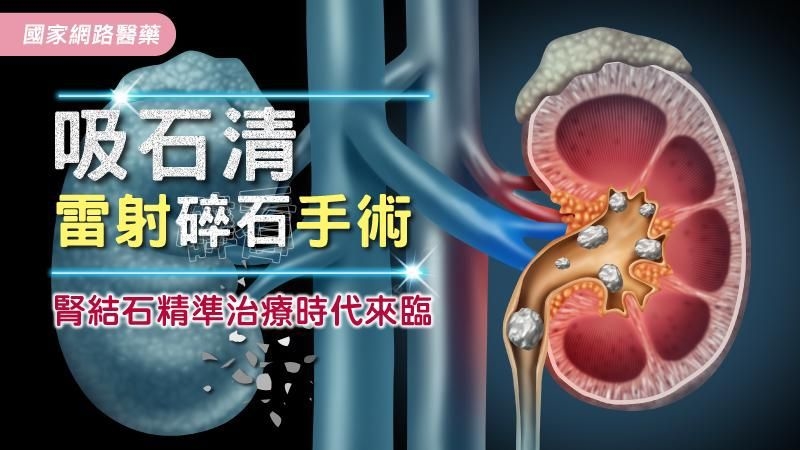 泌尿專科治療中心｜長安醫院