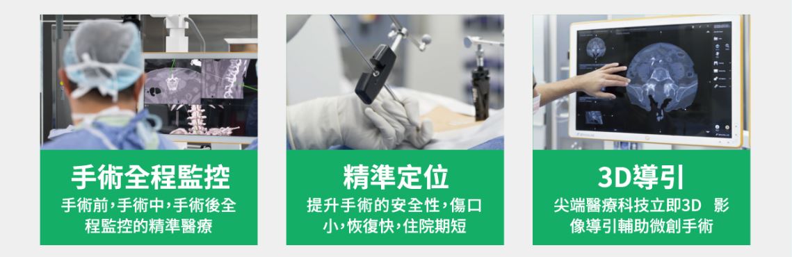 AIRO手術導航系統，您安全的首選！｜長安醫院