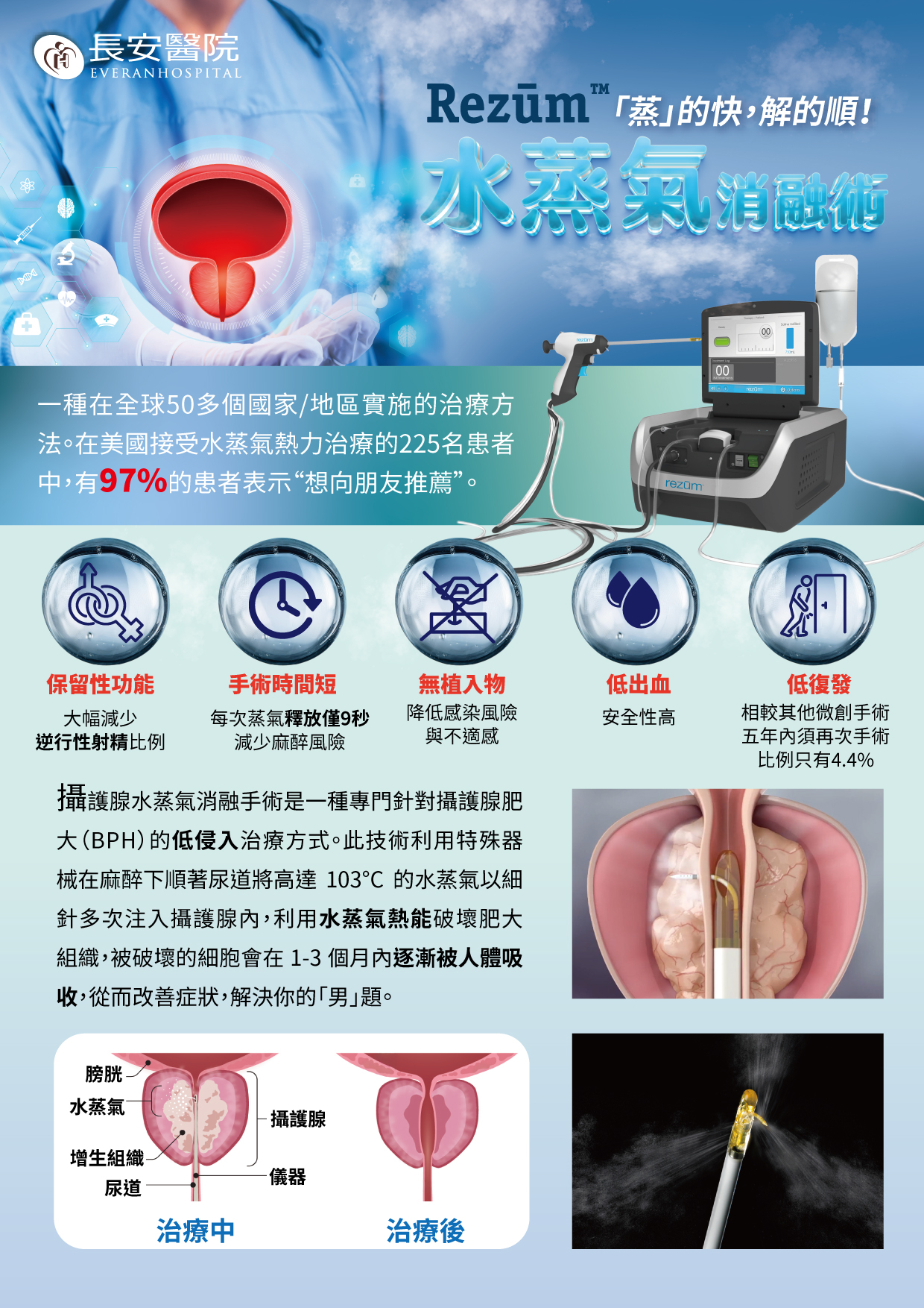 泌尿專科治療中心｜長安醫院
