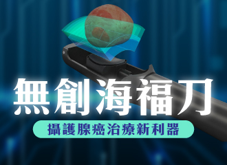 無創海福刀HIFU手術，攝護腺癌治療新利器｜長安醫院
