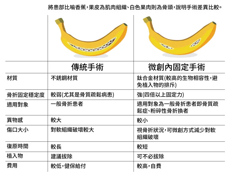 骨折創傷微創內固定手術(MIPO)